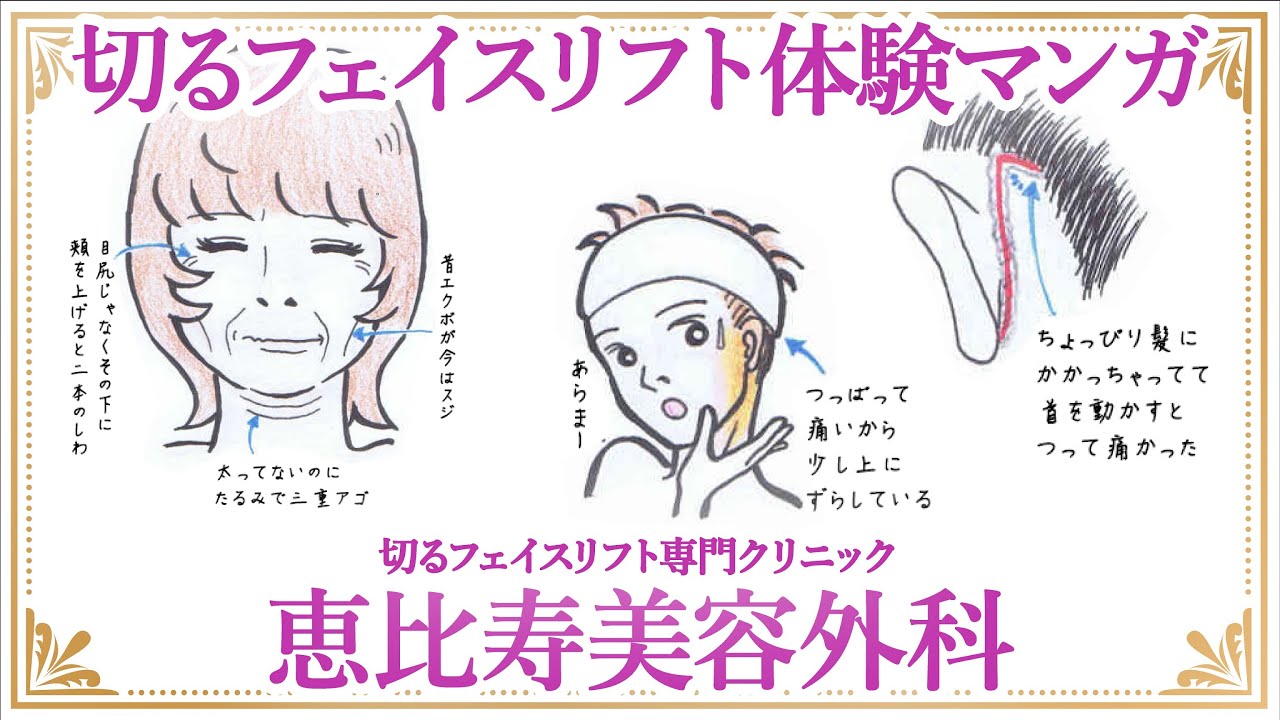 切るフェイスリフト 体験マンガ - YouTube