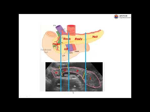 췌장 스캔법(1)