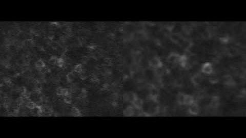 Motion correction (image stabilization) of shaky neural recording