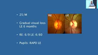 AIOC2024  GP42 Topic  Dr Rashmin Gandhi Optic disc pallor Is it always a neurological cause