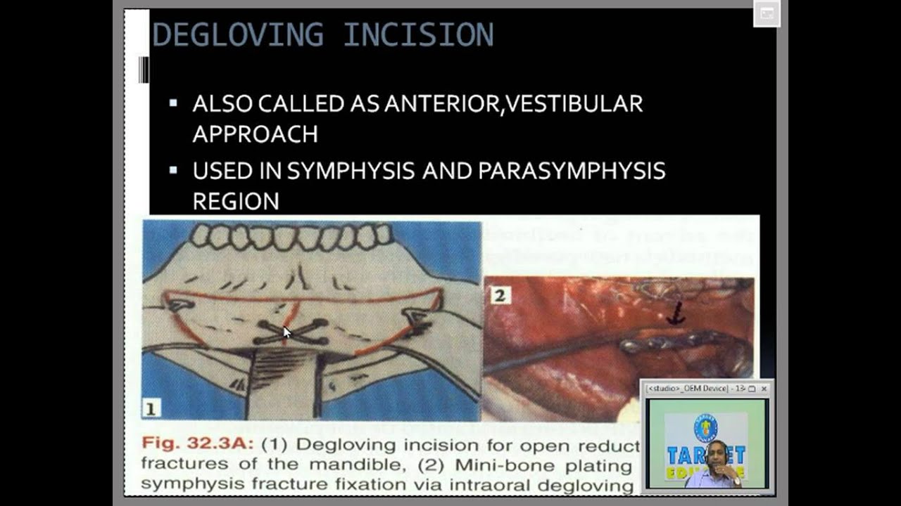 Oral Surgery YouTube