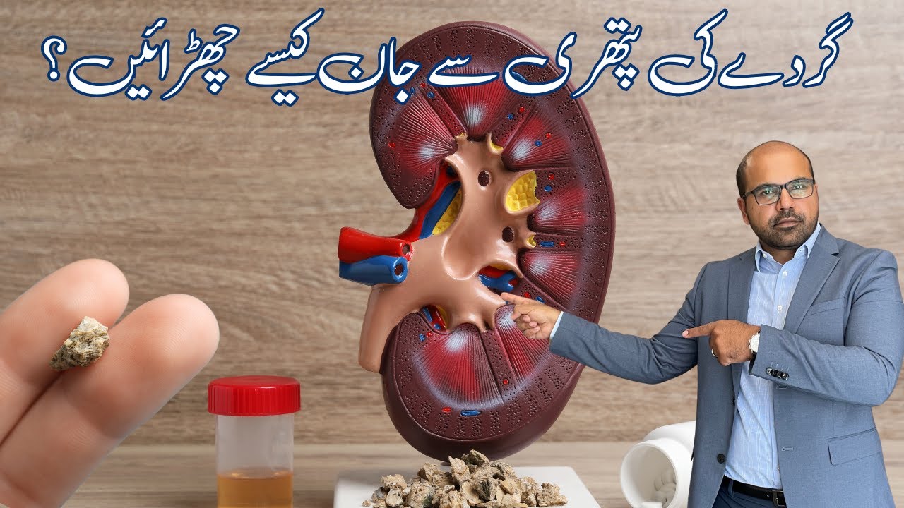 Устали от КАМНЕЙ В ПОЧКАХ? | Kidneyblogs.com | Эпизод 176