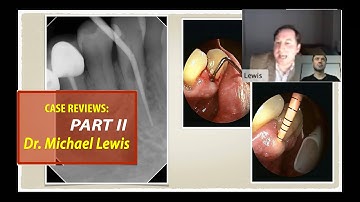 Case Reviews with Dr. Michael Lewis (Part 2 of 3)