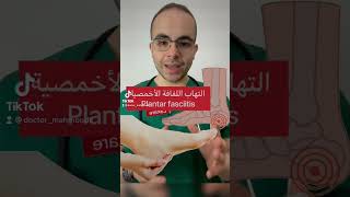 التهاب اللفافة الأخمصية ? plantar fasciitis