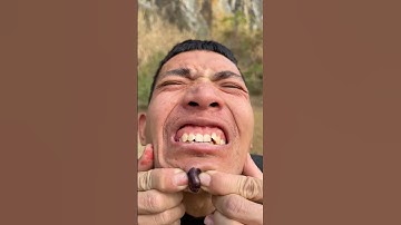 How I Cured a Bug Bite with Yogurt in theWild | Survival Hacks