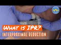 Interproximal Reduction (IPR) on Teeth for Braces and Invisalign