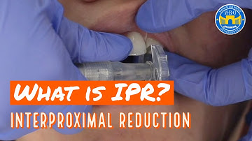 Interproximal Reduction (IPR) on Teeth for Braces and Invisalign