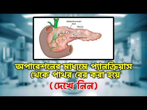 ভিডিও: করণিক অপারেশন কি?