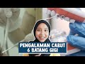 Pengalaman Cabut 6 Batang Gigi