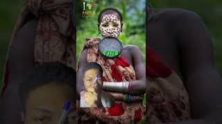 Lip Disc Ornamentation in the Mursi Tribe of Ethiopia