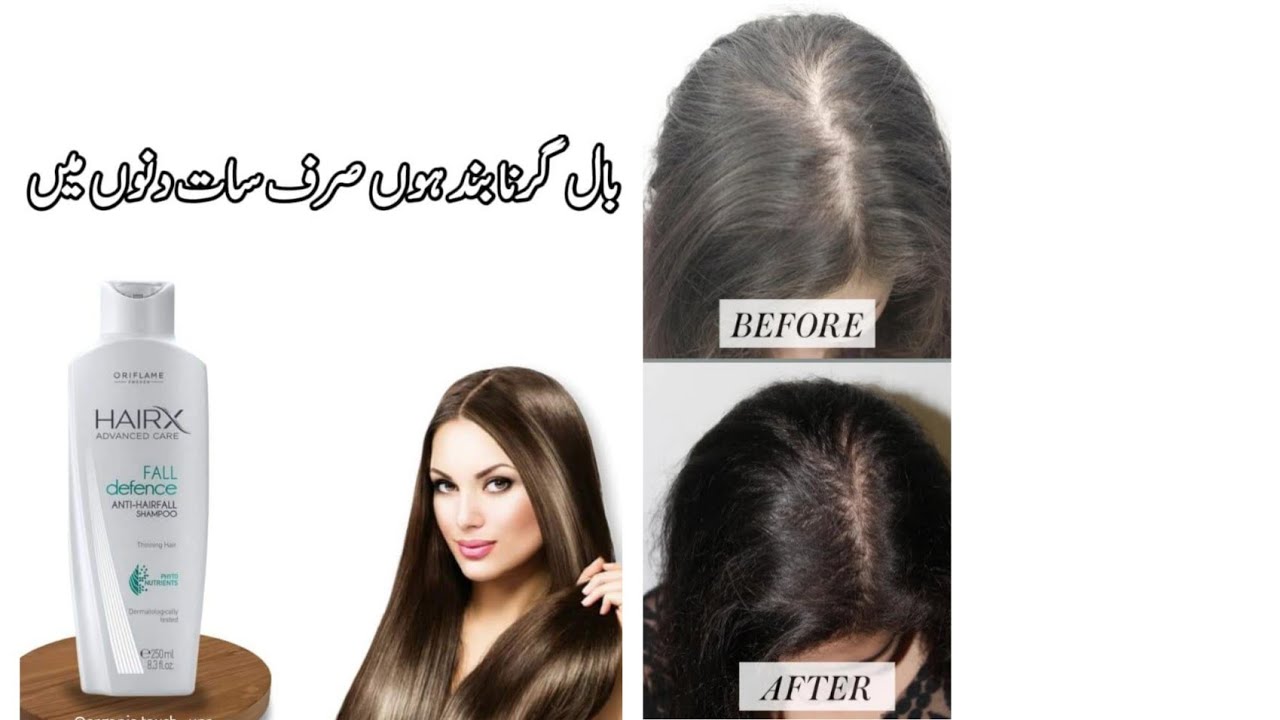Hair fall treatment/How to use Hair x tonic/Oriflame amazingproducts