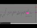 VIX75 Live Trade Mangement