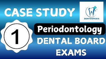 Periodontitis Case Study 1 for  AFK, ACJ, ORE, MFDS, ADC, LDS, INBDE Dental Board Exam Preparation