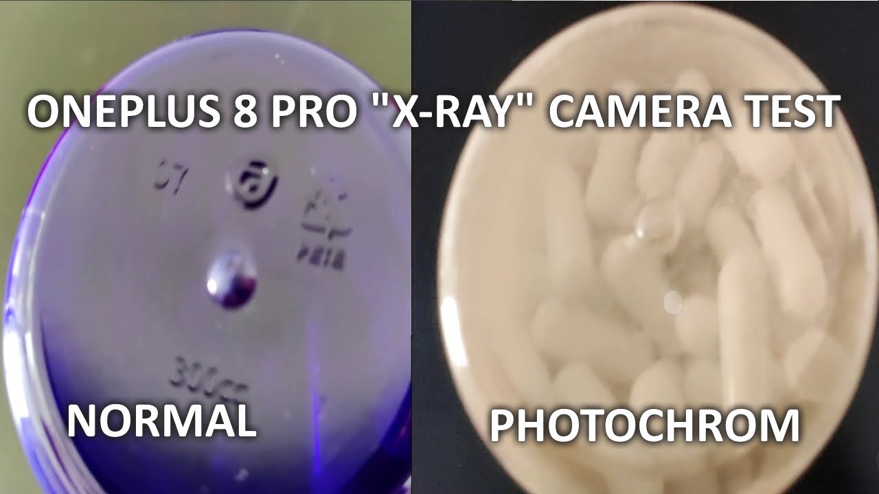 Oneplus X Ray Filter : Pin On X Ray Camera Nude - See how 