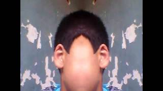 Gulmeli̇ Seki̇ller İlki̇n Olaraq