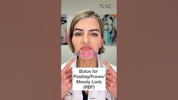 #daobotox #chinbotox #lowerfacebotox #botox #botoxtraining #drbitafarrell #beauty