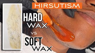 Using Hard & Soft Wax on Hormonal Hair #Hirsutism #FaceWax screenshot 1