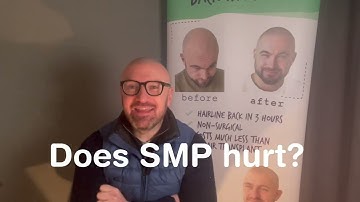 The truth! Does SMP Hurt?  #hairloss #baldness #Scalptattoo #SMP