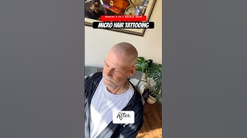 Session 2 of 3 Results Shown #smp #scalpmicropigmentation #hairlosstreatment #smptraining #edmonton