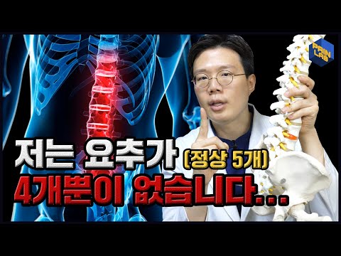 요추가 4개뿐이 없습니다 | 꽤 흔할  수 있는 변이 | &rsquo;요추의 천추화&rsquo;