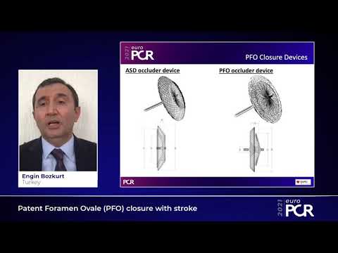 Patent Foramen Ovale (PFO) closure with stroke - EuroPCR 2021