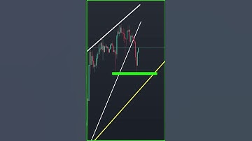 Ethereum price prediction #ethereumtoday #ethereum #eth #shorts #altcoinbitcoin