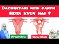 Uterine Fibroid.What Causes Fibroid In Uterus? बच्चेदानी में गांठ क्यों होता है?
