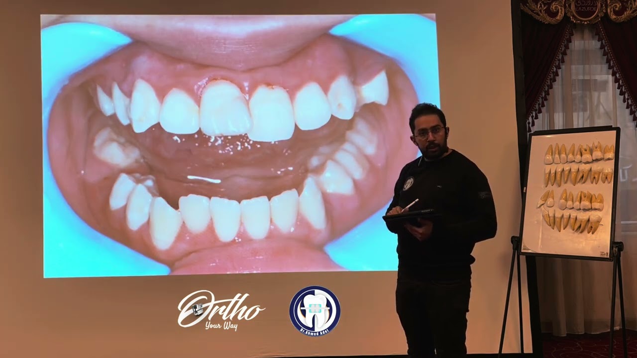 Case Club discussion مناقشه حاله تقويم بالكامل من اول التشخيص وخطه العلاج الي مرحله التثبيت