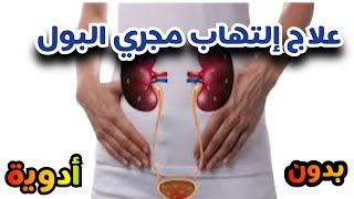 علاج اعراض التهابات المسالك البوليه؟#اسباب التهاب البول