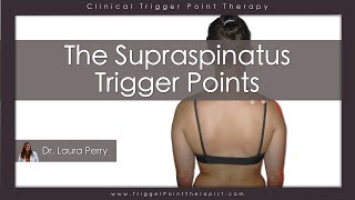 The Supraspinatus Trigger Points