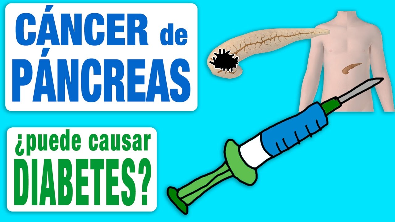 dieta macrobiotica para cancer de pancreas