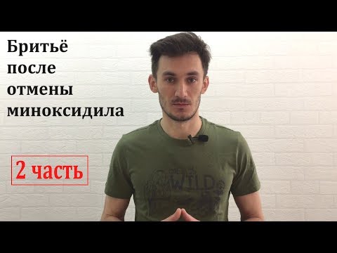 Бритье после отмены миноксидила. 5 месяцев после