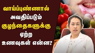 Download lagu குழந்தைகளுக்கு வாய்ப்புண் வர காரணம் என்ன தெரியுமா? | Samayam Tamil Lifestyle