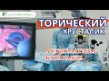 ТОРИЧЕСКИЙ хрусталик. Факичные линзы 🤓Лечение астигматизма и катаркты