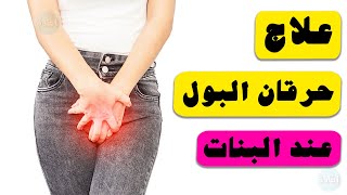 علاج حرقان البول عند البنات