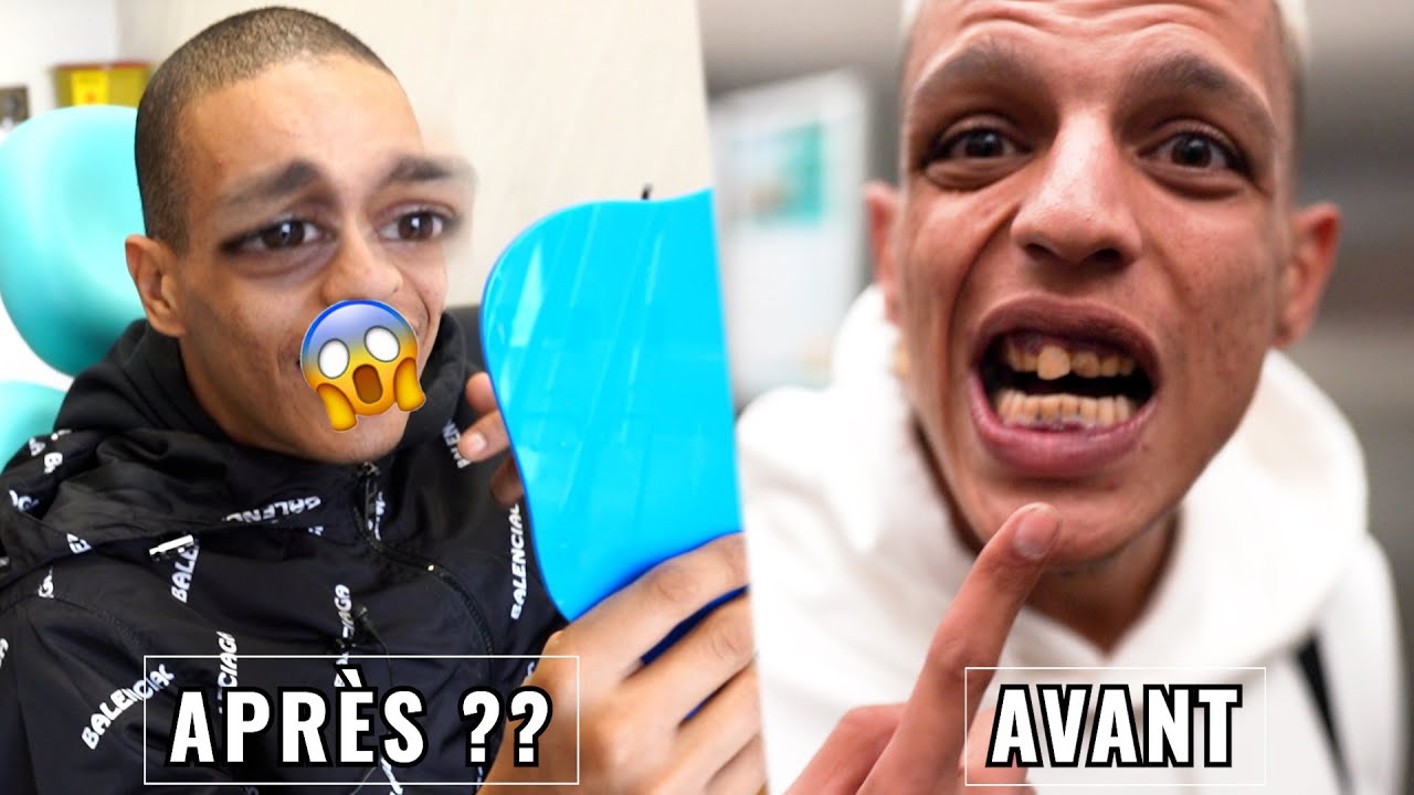 SAMOS a REFAIT ses DENTS 😱🦷 #clinique #samos