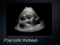 Abdominal and Renal Ultrasound