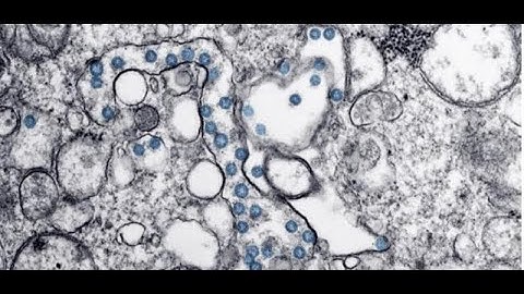 Prof. Cecilia Mascolo - "Listening to your health: Mobile Health Diagnostics through Audio Signals"