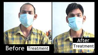 Comfortable Hair Patch | Hair Patch For Men In Delhi | Hair Patch In Delhi screenshot 5