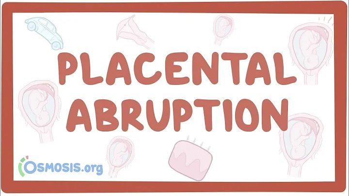 Placental abruption - causes, symptoms, diagnosis, treatment, pathology - DayDayNews