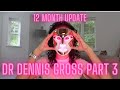 Dr Dennis Gross (PART 3) #LEDmask​ #DrDennisGross​ #shorts