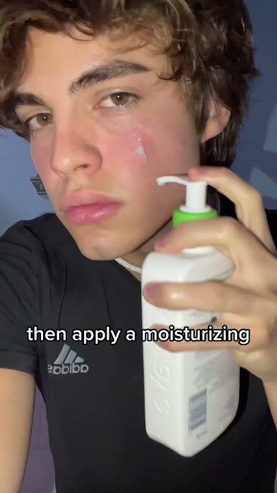 How to avoid acne
