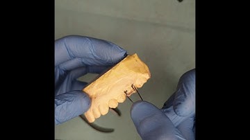 how to fabricate Adams clasp  step by step