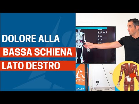 Dolore BASSA SCHIENA LATO DESTRO: ecco le (soprendenti) cause e rimedi