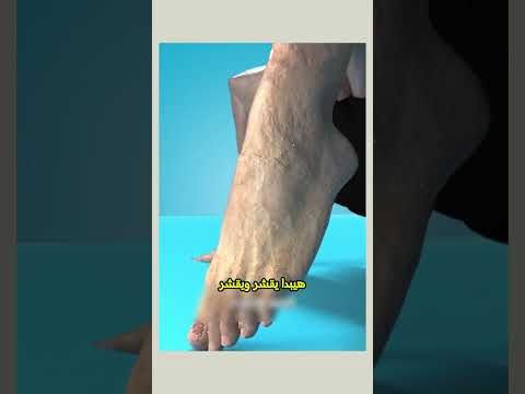 تعرف انك تقدر تزرع نباتات علي رجليك