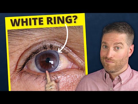 וִידֵאוֹ: האם לעיניים טבעיות יש טבעת גפיים?