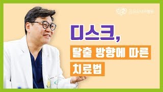 디스크 치료법, 디스크 탈출방향에 따라 달라진다
