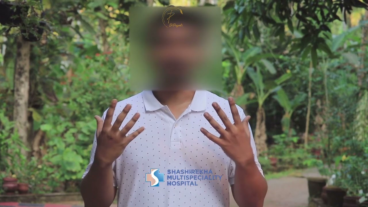 Experience of our patient who underwent chest liposuction for gynecomastia.