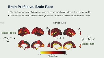 OHBM 2025 | Symposium | Niousha Dehestani | Longitudinal Insights into Adolescent Mental Health: I…