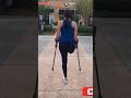 Amputee woman crutches life after amputation #limbloss